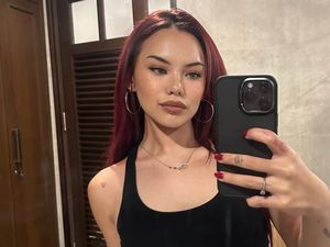 Shafa Harris Jalani Operasi Hidung Lagi