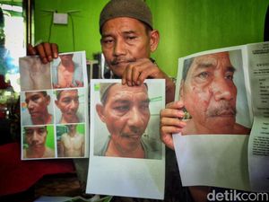 Polres Sukabumi Selidiki Kasus Oknum ASN Diduga Cakar Warga