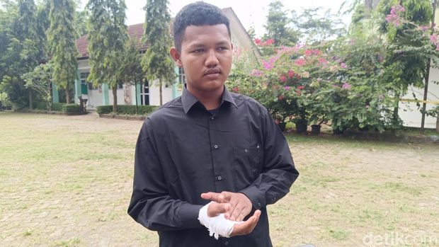 Siswa kelas XII Austian, korban luka atap SMK di Cileungsi ambruk. (Rizky/detikcom)