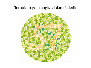 Tes Buta Warna! Tak Bisa Tebak Angka di Gambar Ini, Tandanya Harus Periksa Tes Buta Warna! Tak Bisa Tebak Angka di Gambar Ini, Tandanya Harus Periksa