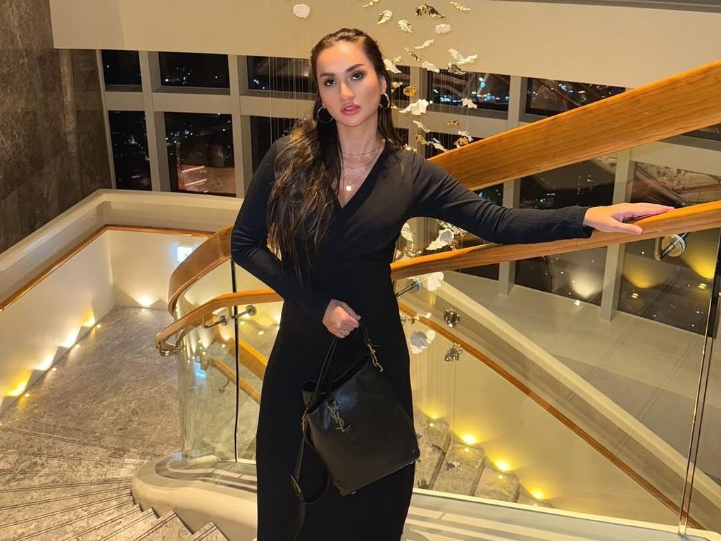 Tengku Dewi Lakukan Berbagai Operasi di Korea, Kuras Bujet Seharga Rumah Tengku Dewi Lakukan Berbagai Operasi di Korea, Kuras Bujet Seharga Rumah