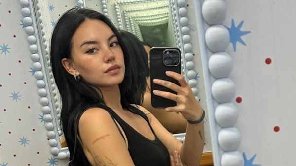 Shafa Harris Rogoh Rp 384 Juta Revisi Hidung, Ungkap Alasan OP Ulang
