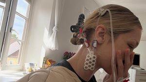 Foto-foto Bella Hadid yang Dirawat Intensif, Kondisinya Bikin Khawatir