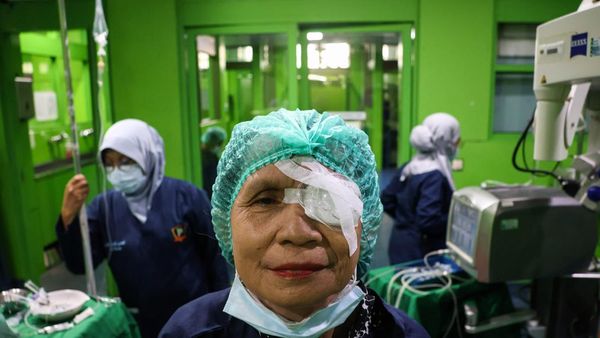 Warga Makassar Antusias Ikuti Baksos Kesehatan: Operasi Katarak hingga Bibir Sumbing
