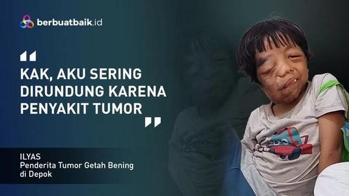 Dirundung Mirip Alien, Anak Tukang Ojek Ingin Hidup dengan Rasa Aman