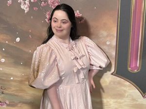 Kisah Model Down Syndrome yang Mendunia, Cetak Sejarah di Vogue Inggris Kisah Model Down Syndrome yang Mendunia, Cetak Sejarah di Vogue Inggris