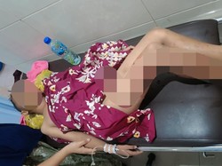 Pulang Ngaji, Bocah di Lombok Timur Diserang 2 Anjing Liar