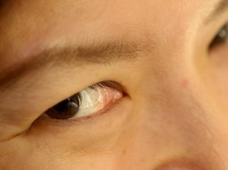 Area Mata Mulai Keriput? Ini 7 Makanan untuk Cegah Penuaan Dini!