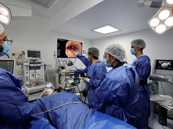 Inovasi Endoskopi Minim Invasif dari Mesir Bantu Atasi Akalasia Berat