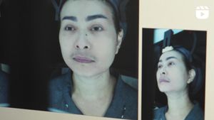 7 Foto Iis Dahlia Jalani Stem Cell di Korea, Makin Awet Muda di Usia 53