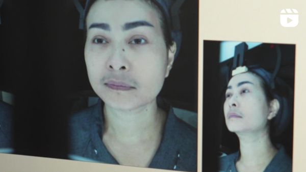 7 Foto Iis Dahlia Jalani Stem Cell di Korea, Makin Awet Muda di Usia 53