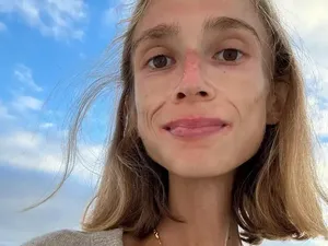 Kronologi Wanita yang Meninggal gegara Diet Ekstrem, Hanya Makan Buah