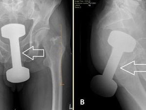 Kisah Dokter Keluarkan Dumbell 2,2 Kg yang Nyangkut di Anus Pria Kisah Dokter Keluarkan Dumbell 2,2 Kg yang Nyangkut di Anus Pria
