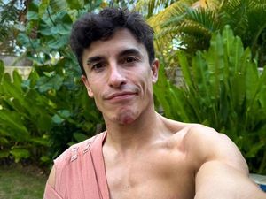 Marc Marquez Absen Dua Seri MotoGP, Wajib Istirahat Total Marc Marquez Absen Dua Seri MotoGP, Wajib Istirahat Total