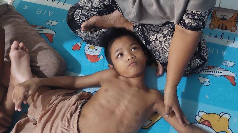 Kisah Pilu Hadijah, Penderita Cerebral Palsy yang Ditelantarkan Ibu