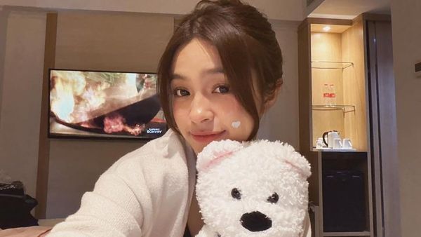 Elsa Japasal Soal Jadi Pelopor Artis Pede dengan Tempelan Jerawat