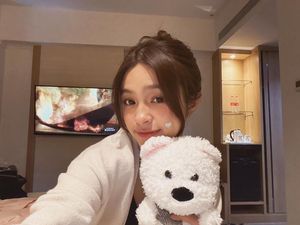 Elsa Japasal Soal Jadi Pelopor Artis Pede dengan Tempelan Jerawat Elsa Japasal Soal Jadi Pelopor Artis Pede dengan Tempelan Jerawat