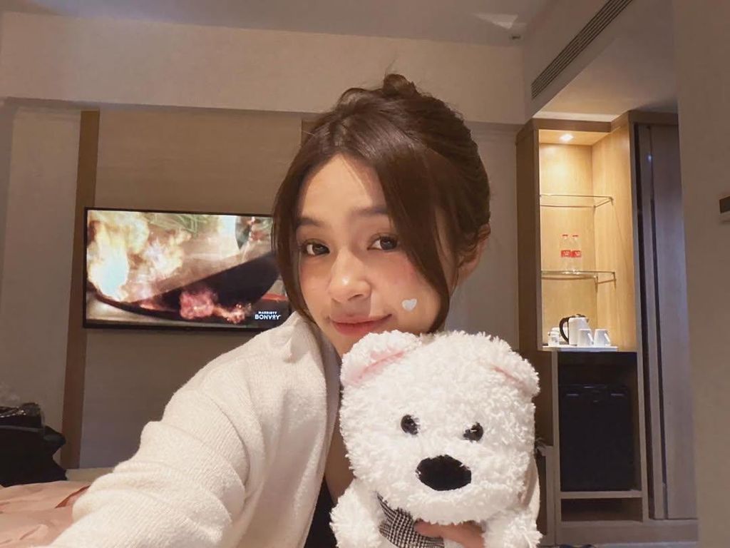 Elsa Japasal Soal Jadi Pelopor Artis Pede dengan Tempelan Jerawat Elsa Japasal Soal Jadi Pelopor Artis Pede dengan Tempelan Jerawat