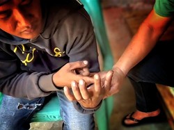 Kisah Edi Diseruduk Babi dari Perburuan Liar di Sukabumi