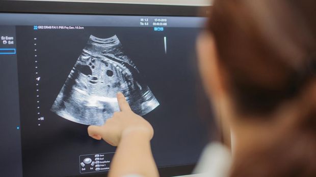 Close-up of asian chinese young doctor showing ultrasound scan on monitor to pregnant woman in doctor room at hospital