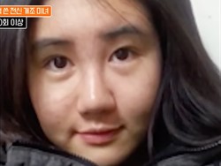 Hasil Operasi Plastik Seharga Rp3,8 Miliar Selama 15 Tahun Hasil Operasi Plastik Seharga Rp3,8 Miliar Selama 15 Tahun