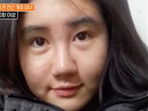 Foto Before-After Wanita Korea 400 Kali Operasi Plastik, Hasilnya Jadi Begini Foto Before-After Wanita Korea 400 Kali Operasi Plastik, Hasilnya Jadi Begini