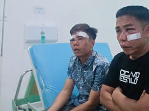 Kades di OKI Diduga Dianiaya Oknum TNI, Korban Alami Luka Serius Kades di OKI Diduga Dianiaya Oknum TNI, Korban Alami Luka Serius