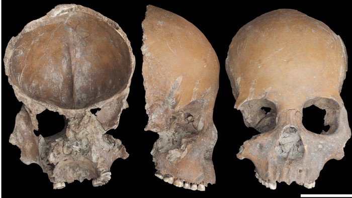 Kisah Mengerikan di Balik Tengkorak Jadi Cawan dan Topeng di China Kuno