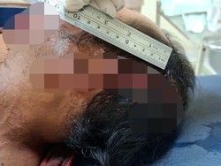 Sengketa Tanah Warisan, Warga Lombok Ditebas Parang oleh Saudaranya