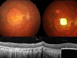 Temuan Chip Mata Kecil oleh Ilmuwan Stanford, Bisa Bantu Orang Buta Melihat Temuan Chip Mata Kecil oleh Ilmuwan Stanford, Bisa Bantu Orang Buta Melihat