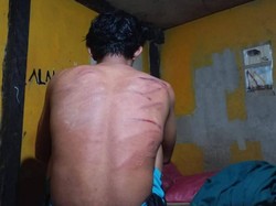 2 Karyawan PT RIM Diduga Dianiaya Oknum BKO TNI 2 Karyawan PT RIM Diduga Dianiaya Oknum BKO TNI