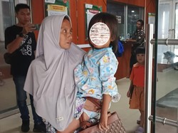 Ibu Bocah SD yang Anaknya Alami Mata Lebam Lapor Polisi, Diduga Dipukul Guru