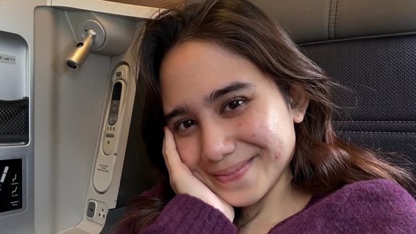 Potret Tissa Biani Pamer Wajah Asli Dengan Kulit Berjerawat, Banjir Pujian