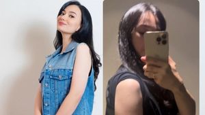 Asmirandah Sedot Lemak Biar Lingkar Paha dan Lengan Kecil