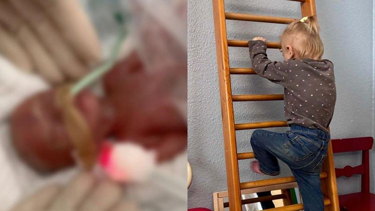 Balita 24 Minggu: Kisah Inspiratif Pejuang Prematur Tumbuh Sehat