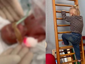 Kisah Haru Balita Tumbuh Sehat Setelah Lahir Prematur di Usia 24 Minggu