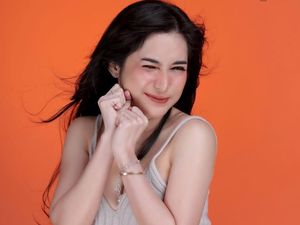 Penampilan Dilan Janiyar Usai Lakukan 3 Operasi di Wajah