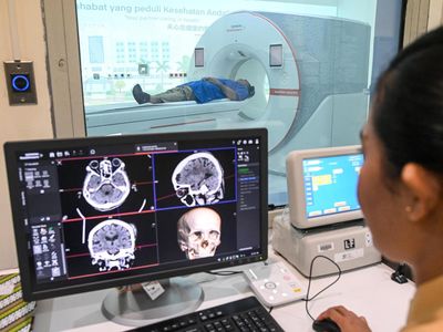 Indonesia Jadi Negara Pertama di Asia Pakai CT Scan Photon Counting