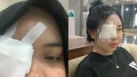 Medsos Kosmetik Pinkflash 'Digeruduk' Konsumen, Keluhkan Iritasi Mata hingga Insisi