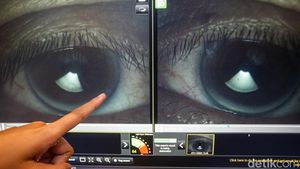 Cek Mata Gratis di Gandaria City, Waspada Mata Kering