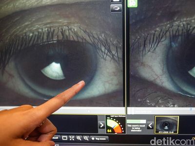 Cek Mata Gratis di Gandaria City, Waspada Mata Kering