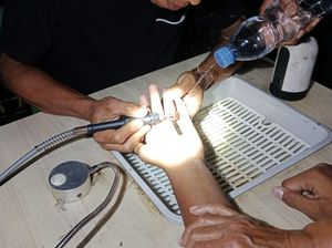 Aksi Damkar Kuningan Turun Selamatkan Jari Anak dari Monster Cincin