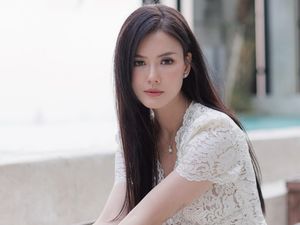 Nita Gunawan Jelaskan Soal Muka Berubah