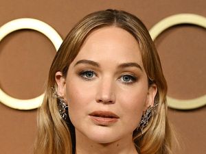 Wajahnya Disebut Berbeda, Jennifer Lawrence Ungkap Semua Prosedur Kecantikannya
