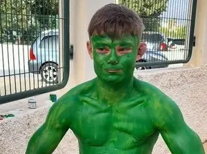 Coba-coba Tiru Hulk, Turis Inggris Ini Malah Ketempelan Cat Hijau