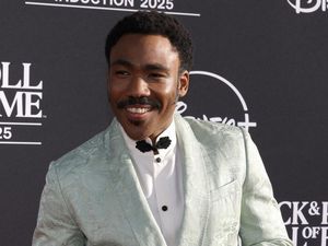 Cerita Donald Glover Antara Hidup dan Mati: Alami Stroke-Jantung Bolong