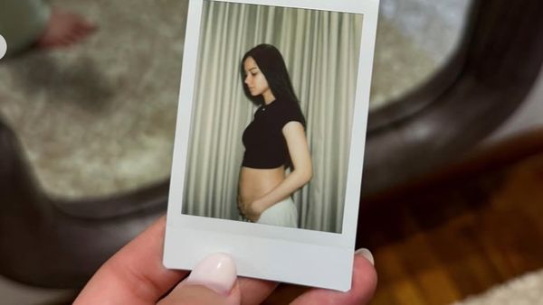 Alyssa Daguise Bagikan Rutinitas Setelah Hamil, Sering Nangis-Pamer Jerawatan