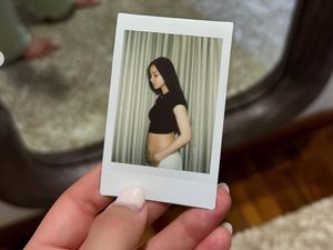 Alyssa Daguise Bagikan Rutinitas Setelah Hamil, Sering Nangis-Pamer Jerawatan