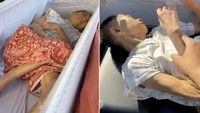 Dianggap Meninggal 2 Hari, Wanita Ini Mendadak Bangung di Peti Mati