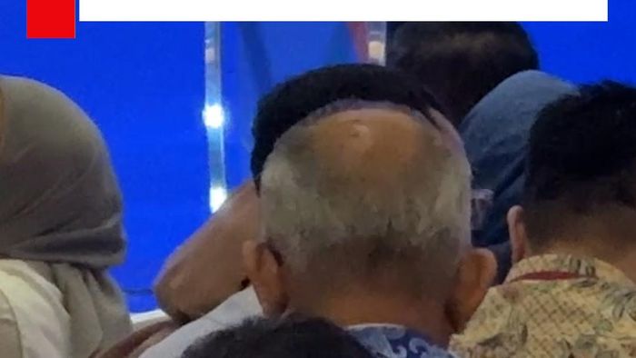 Video: Menkes Sentil Fasilitas Kesehatan RI, Soroti Warga Pilih Berobat ke LN